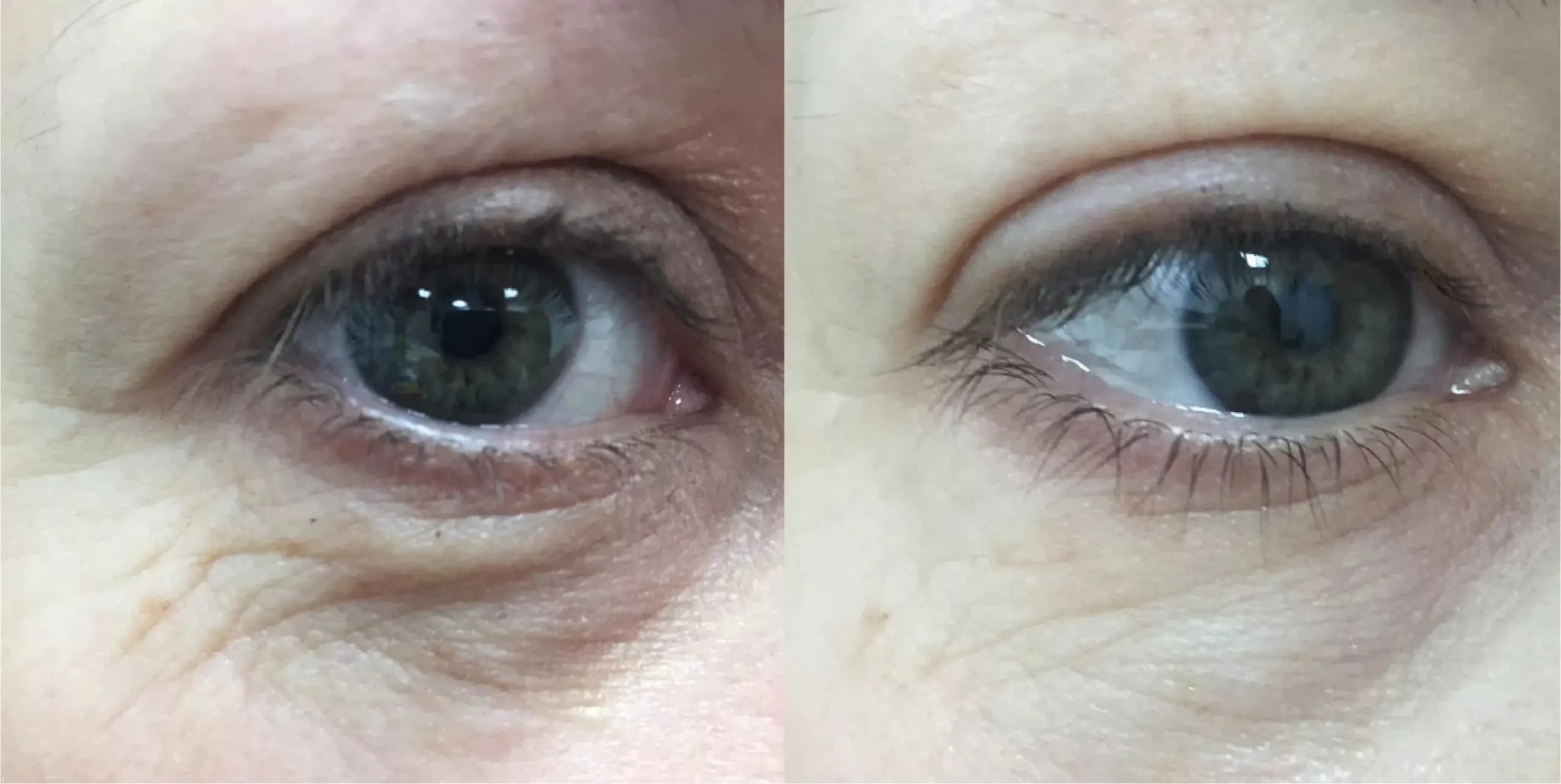 Smooth Eye