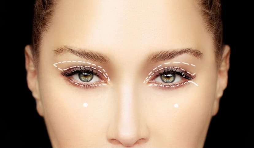 Lidstraffung (Blepharoplastik)
